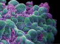 /album/ciencia-del-aloe/celulas-tumorales-de-mama-wellcome-images-sinc-xlarge-jpg/